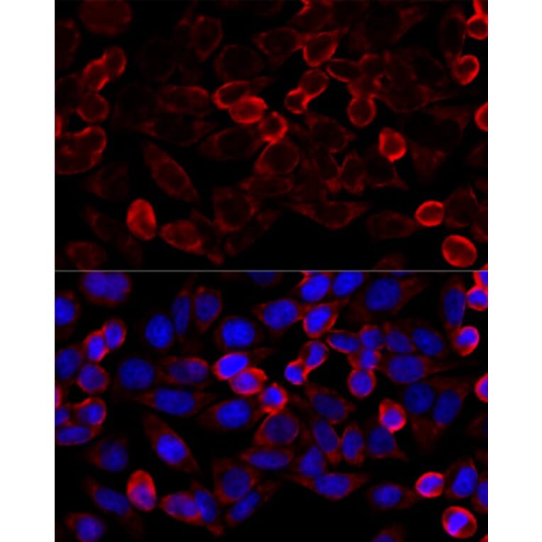 Immunofluorescence - Anti-HDAC6 Antibody (A80508) - Antibodies.com