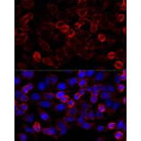 Immunofluorescence - Anti-HDAC6 Antibody (A80508) - Antibodies.com