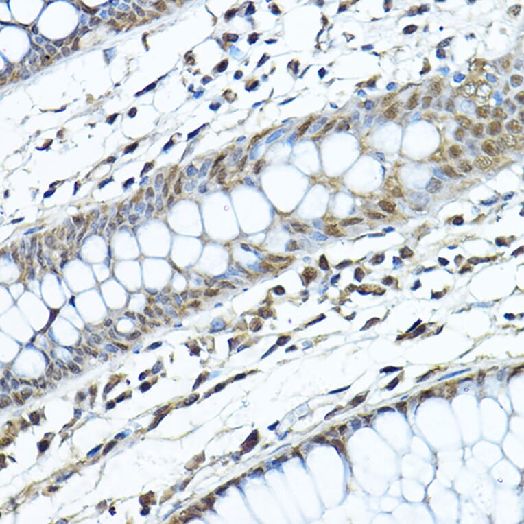 Immunohistochemistry - Anti-SIRT1 Antibody (A80509) - Antibodies.com