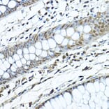 Immunohistochemistry - Anti-SIRT1 Antibody (A80509) - Antibodies.com