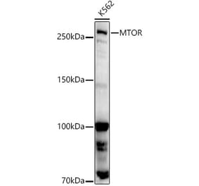 Western Blot - Anti-mTOR Antibody (A80511) - Antibodies.com