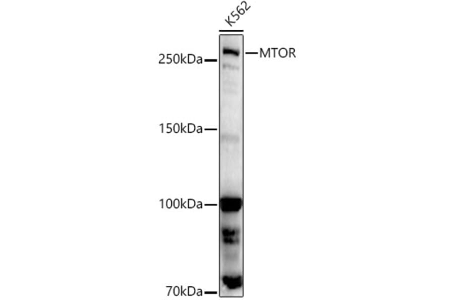 Western Blot - Anti-mTOR Antibody (A80511) - Antibodies.com
