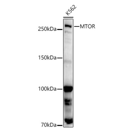 Western Blot - Anti-mTOR Antibody (A80511) - Antibodies.com