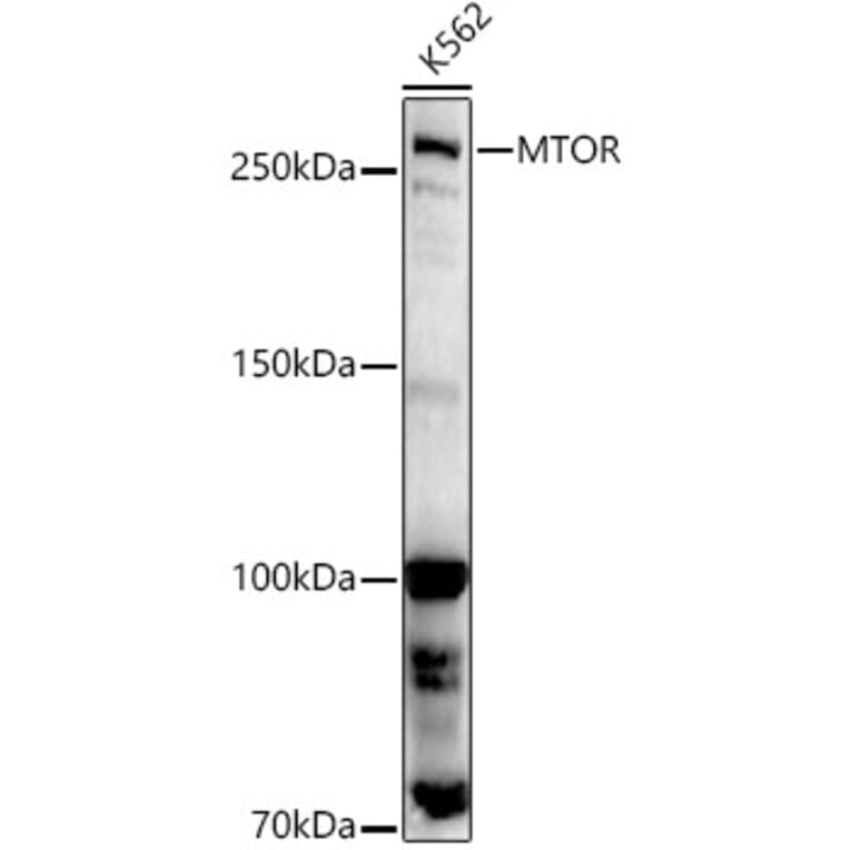Western Blot - Anti-mTOR Antibody (A80511) - Antibodies.com