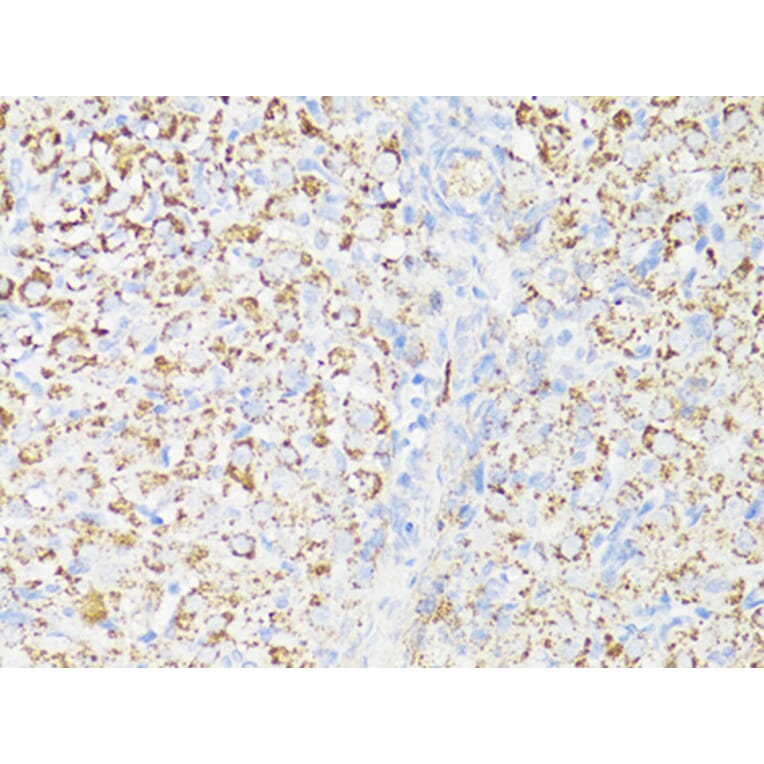 Immunohistochemistry - Anti-mTOR Antibody (A80511) - Antibodies.com