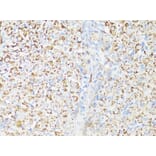 Immunohistochemistry - Anti-mTOR Antibody (A80511) - Antibodies.com