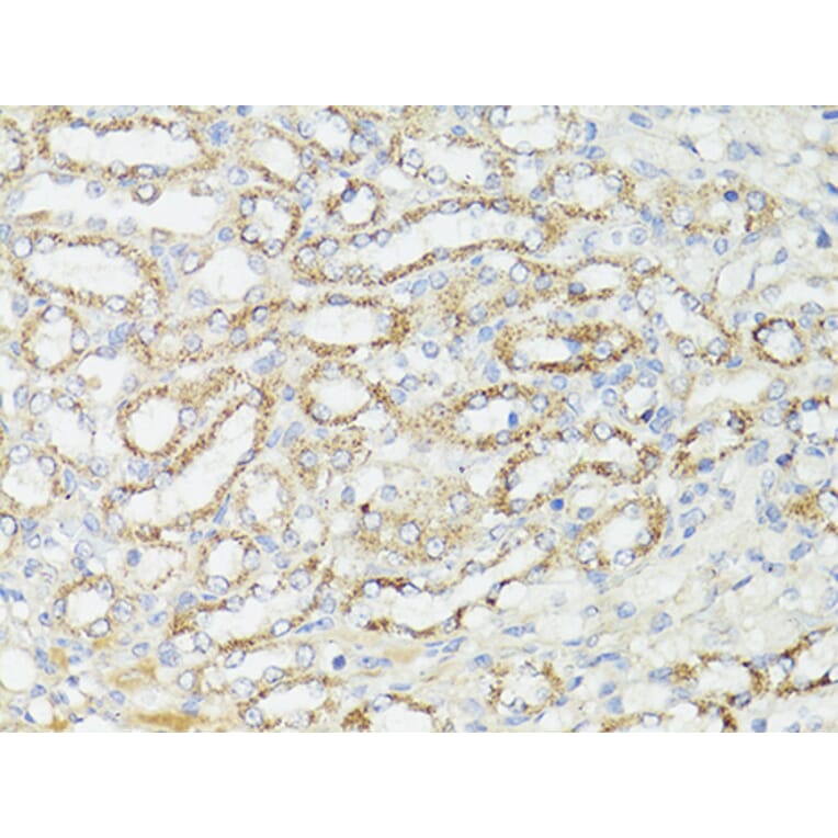 Immunohistochemistry - Anti-mTOR Antibody (A80511) - Antibodies.com