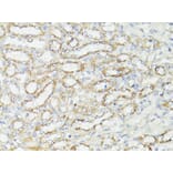 Immunohistochemistry - Anti-mTOR Antibody (A80511) - Antibodies.com