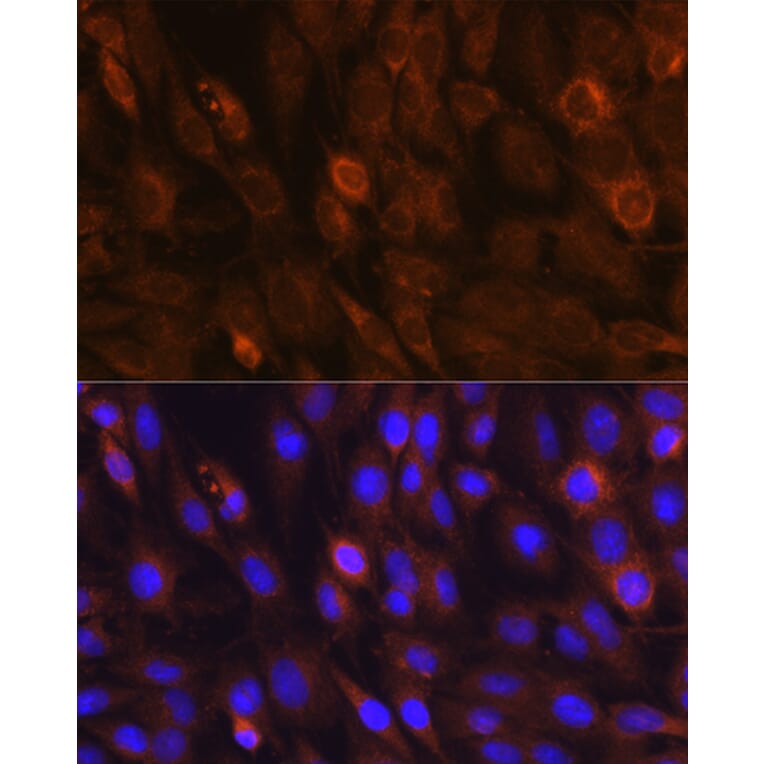 Anti-mTOR Antibody (A80511) | Antibodies.com