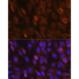 Immunofluorescence - Anti-mTOR Antibody (A80511) - Antibodies.com