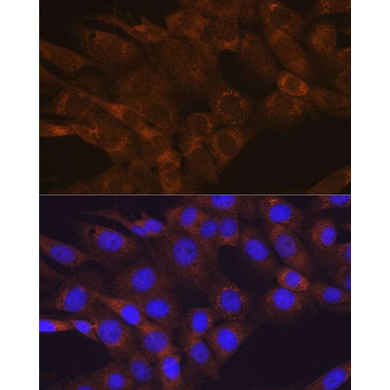 Immunofluorescence - Anti-mTOR Antibody (A80511) - Antibodies.com