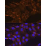Immunofluorescence - Anti-mTOR Antibody (A80511) - Antibodies.com