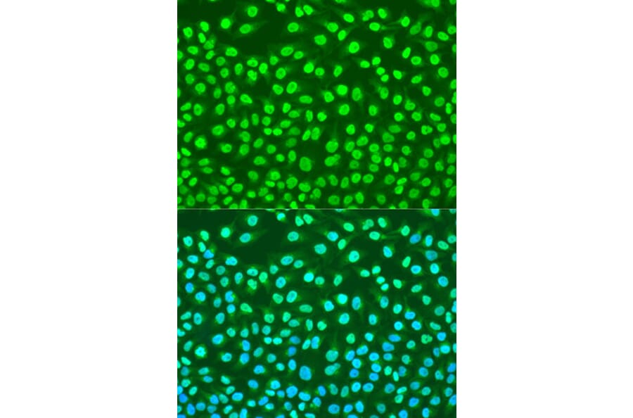 Immunofluorescence - Anti-Histone H2AX Antibody (A11361) - Antibodies.com