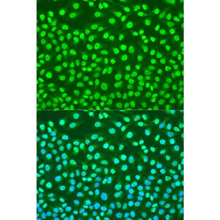 Immunofluorescence - Anti-Histone H2AX Antibody (A11361) - Antibodies.com