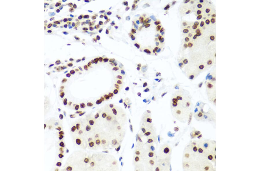 Immunohistochemistry - Anti-Histone H2AX Antibody (A11361) - Antibodies.com