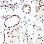 Immunohistochemistry - Anti-Histone H2AX Antibody (A11361) - Antibodies.com