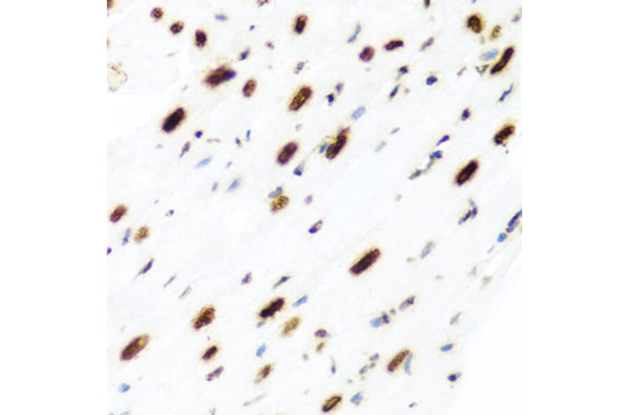 Immunohistochemistry - Anti-Histone H2AX Antibody (A11361) - Antibodies.com