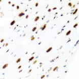 Immunohistochemistry - Anti-Histone H2AX Antibody (A11361) - Antibodies.com