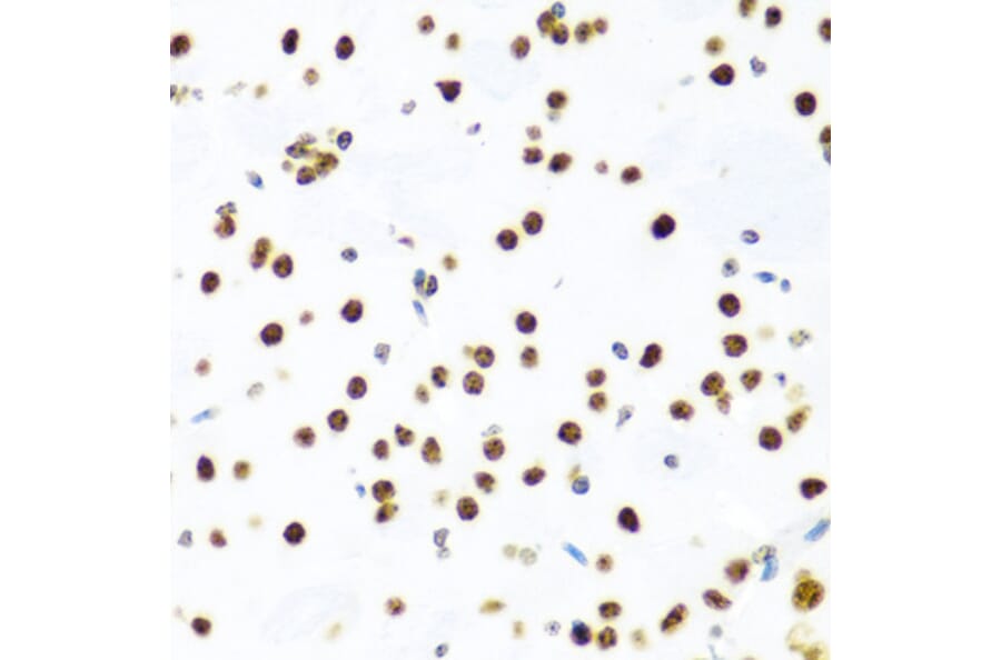 Immunohistochemistry - Anti-Histone H2AX Antibody (A11361) - Antibodies.com