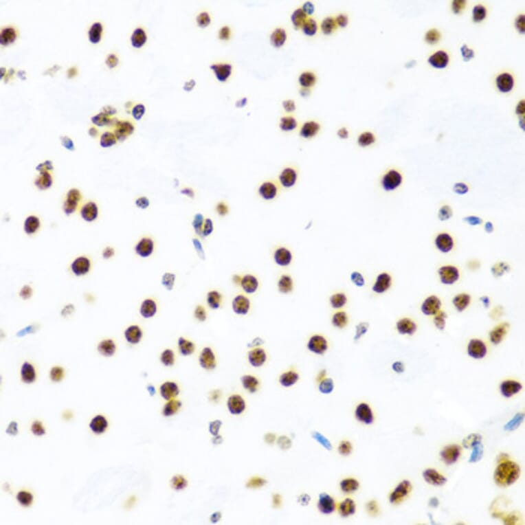 Immunohistochemistry - Anti-Histone H2AX Antibody (A11361) - Antibodies.com