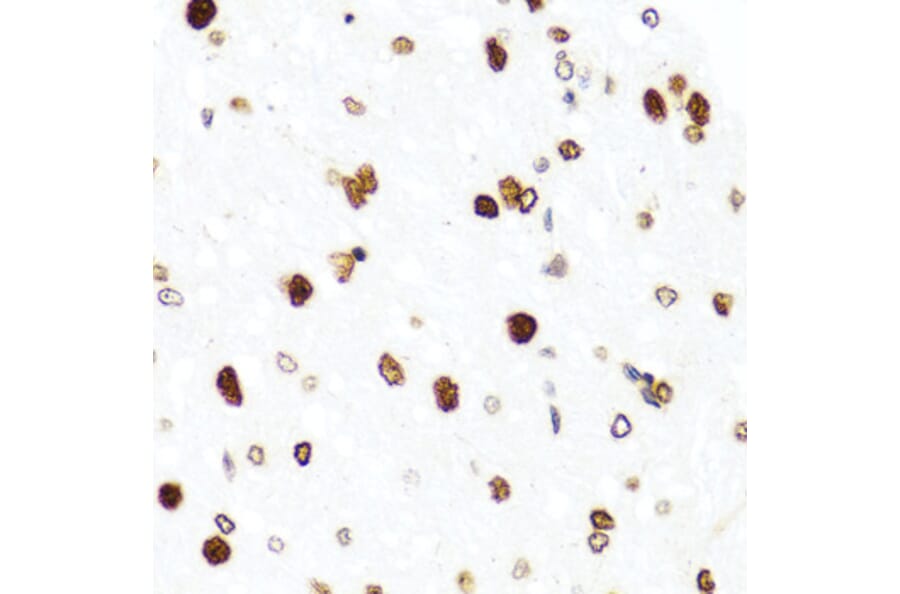Immunohistochemistry - Anti-Histone H2AX Antibody (A11361) - Antibodies.com