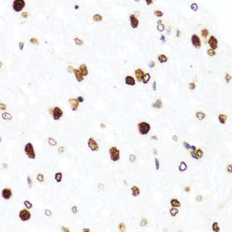 Immunohistochemistry - Anti-Histone H2AX Antibody (A11361) - Antibodies.com