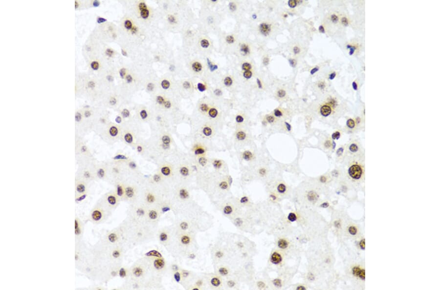 Immunohistochemistry - Anti-Histone H2AX Antibody (A11361) - Antibodies.com