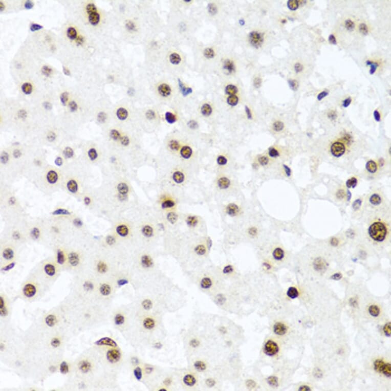 Immunohistochemistry - Anti-Histone H2AX Antibody (A11361) - Antibodies.com