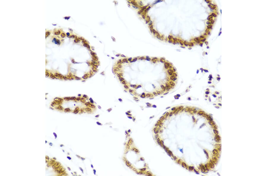 Immunohistochemistry - Anti-Histone H2AX Antibody (A11361) - Antibodies.com