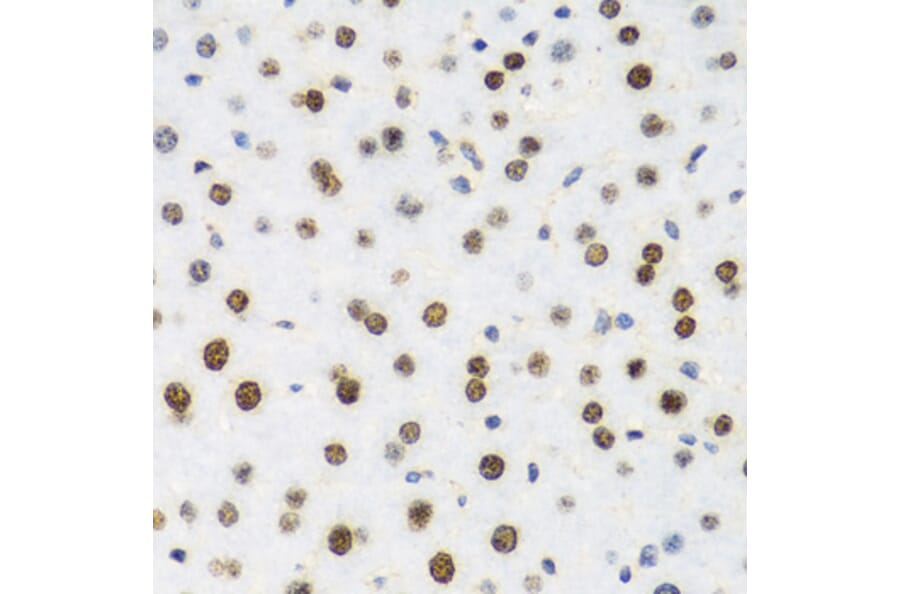 Immunohistochemistry - Anti-Histone H2AX Antibody (A11361) - Antibodies.com