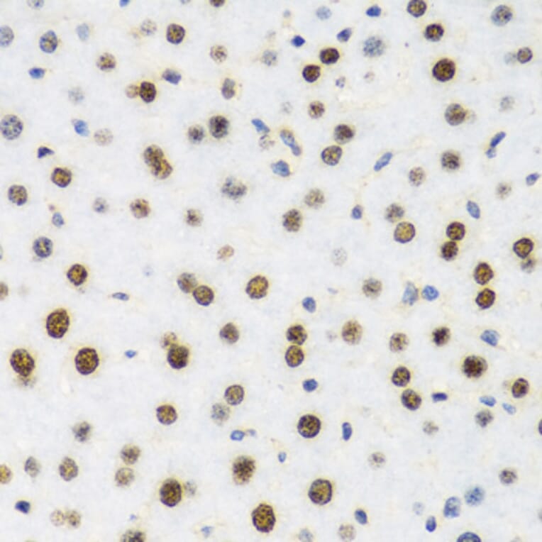 Immunohistochemistry - Anti-Histone H2AX Antibody (A11361) - Antibodies.com