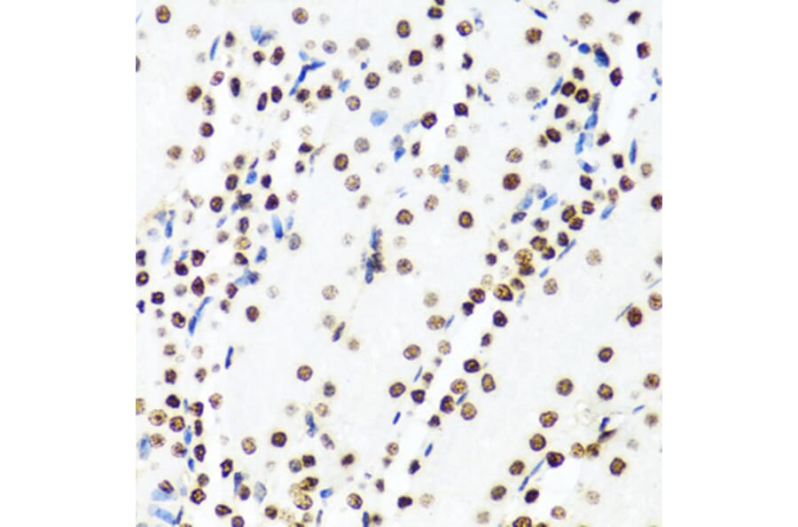Immunohistochemistry - Anti-Histone H2AX Antibody (A11361) - Antibodies.com