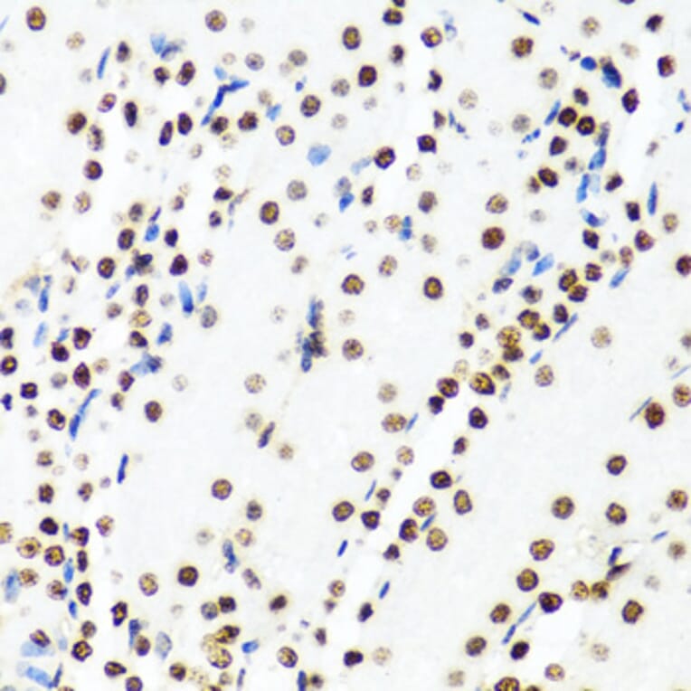 Immunohistochemistry - Anti-Histone H2AX Antibody (A11361) - Antibodies.com