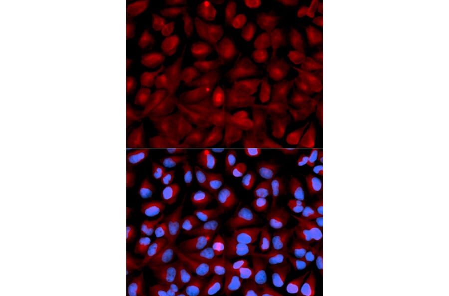 Immunofluorescence - Anti-HDAC6 Antibody (A80513) - Antibodies.com