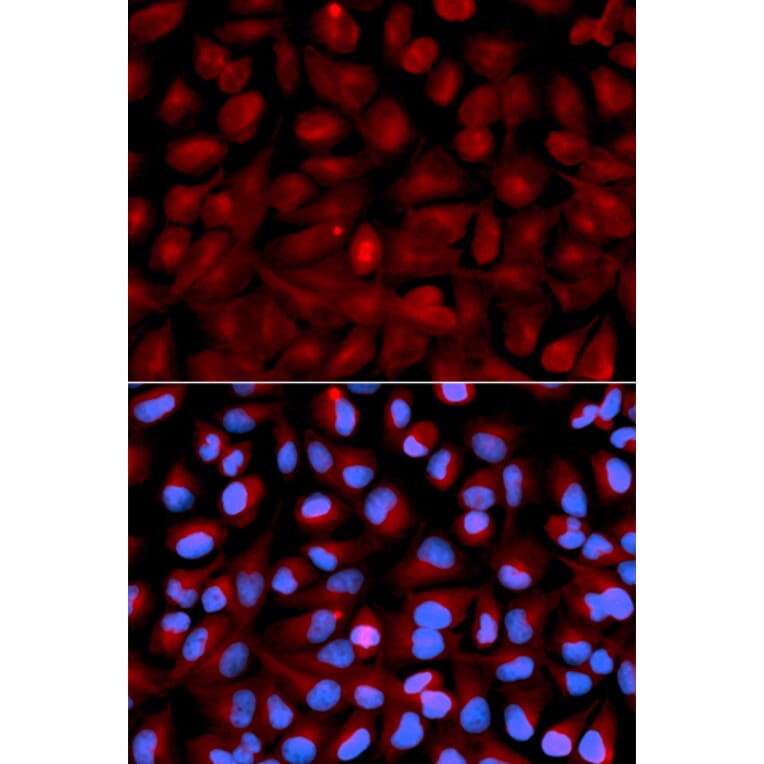 Immunofluorescence - Anti-HDAC6 Antibody (A80513) - Antibodies.com