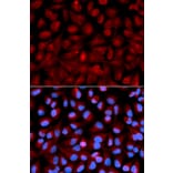 Immunofluorescence - Anti-HDAC6 Antibody (A80513) - Antibodies.com