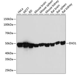 Western Blot - Anti-ENO1 Antibody [ARC0599] (A80514) - Antibodies.com