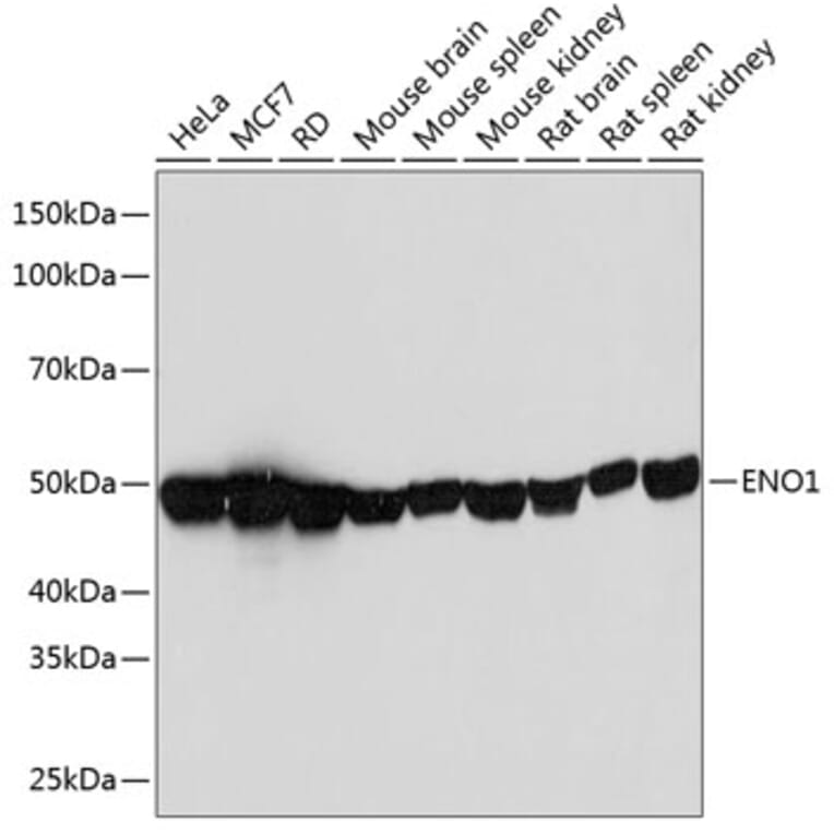 Western Blot - Anti-ENO1 Antibody [ARC0599] (A80514) - Antibodies.com