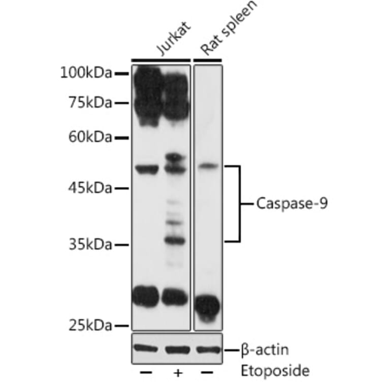 Western Blot - Anti-Caspase-9 Antibody (A80515) - Antibodies.com