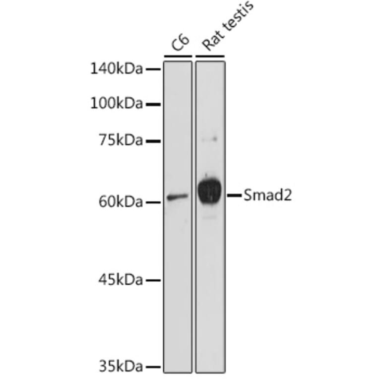 Western Blot - Anti-Smad2 Antibody (A80517) - Antibodies.com