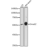 Western Blot - Anti-Smad2 Antibody (A80517) - Antibodies.com