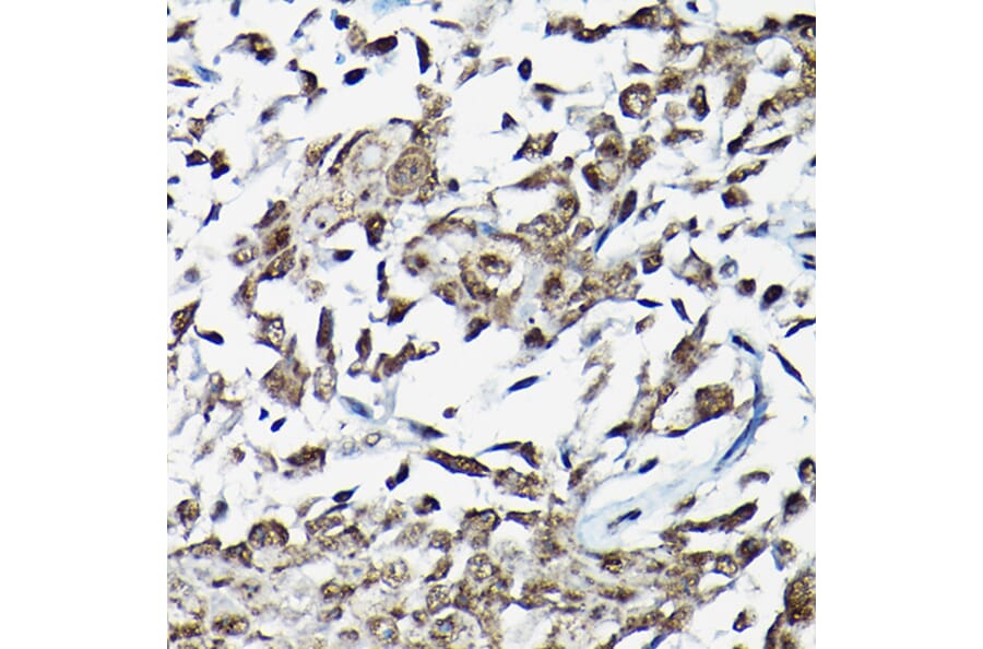 Immunohistochemistry - Anti-Smad2 Antibody (A80517) - Antibodies.com