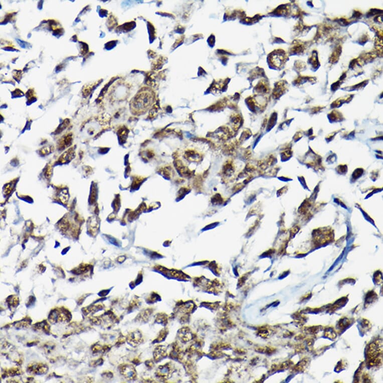 Immunohistochemistry - Anti-Smad2 Antibody (A80517) - Antibodies.com
