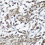 Immunohistochemistry - Anti-Smad2 Antibody (A80517) - Antibodies.com