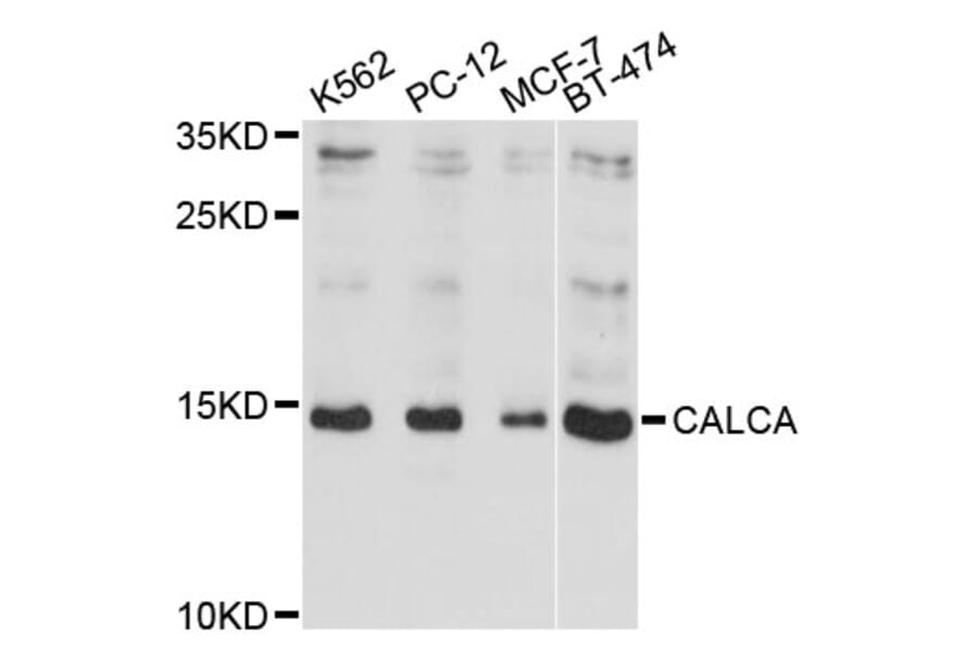 Western Blot - Anti-CALCA Antibody (A11804) - Antibodies.com