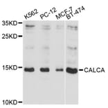 Western Blot - Anti-CALCA Antibody (A11804) - Antibodies.com