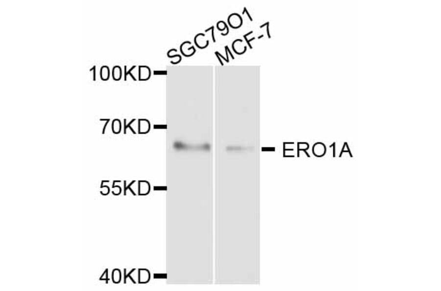 Western Blot - Anti-ERO1A Antibody (A11806) - Antibodies.com