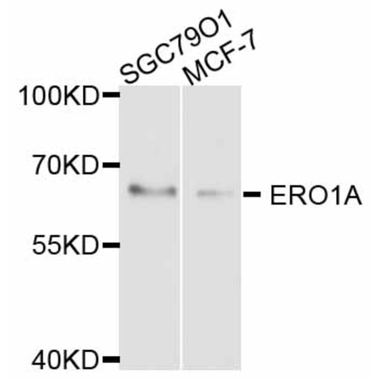 Western Blot - Anti-ERO1A Antibody (A11806) - Antibodies.com
