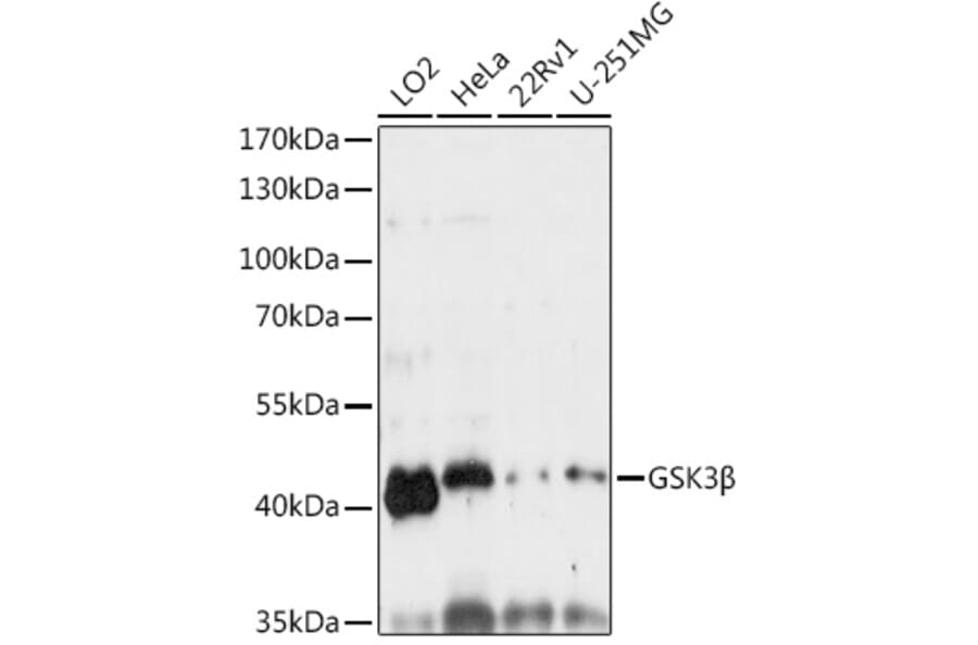 Western Blot - Anti-GSK3 beta Antibody (A80524) - Antibodies.com