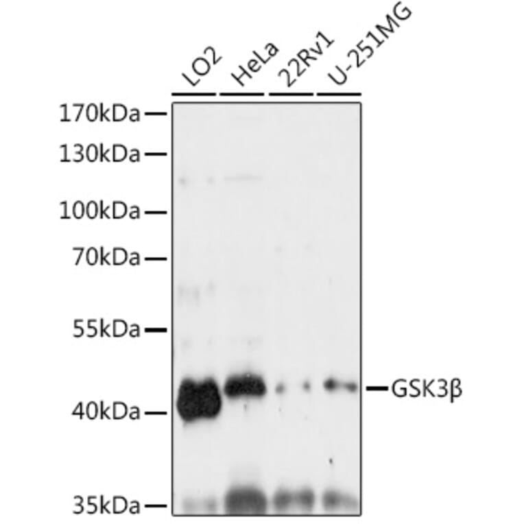 Western Blot - Anti-GSK3 beta Antibody (A80524) - Antibodies.com